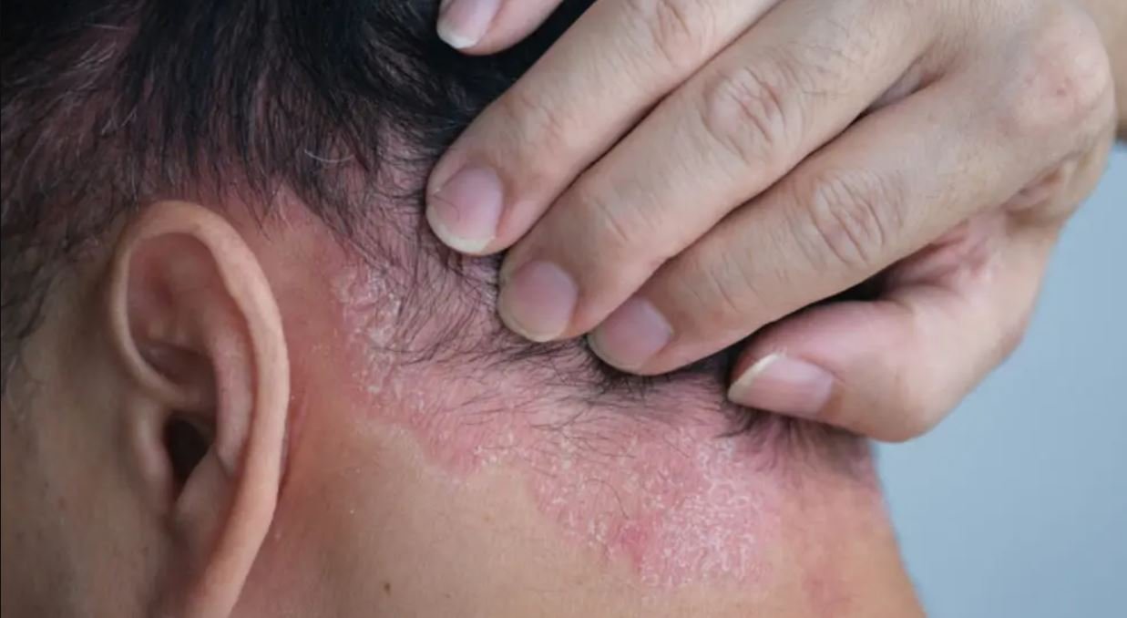 Dəri xəstəlikləri